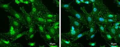 Immunocytochemistry/ Immunofluorescence: FAK [p Tyr576] Antibody [NBP3-13071]